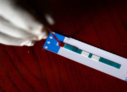 В ООН приветствовали принятие в США нового пакета финансирования борьбы с ВИЧ/СПИДом